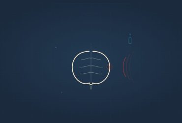 FDM illustration - brain with directed energy waves