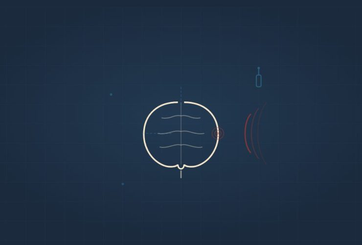 FDM illustration - brain with directed energy waves